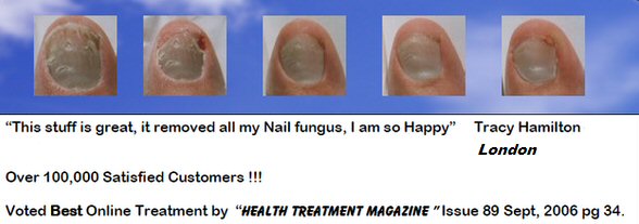nail fungus picture - the healing process
